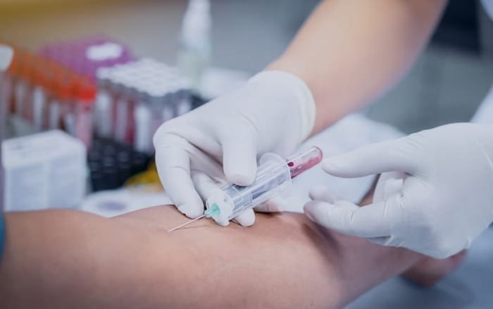 Blood Tests